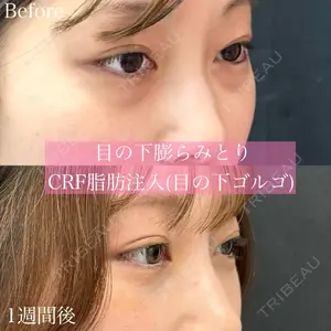 ルラ美容クリニック 渋谷本院 昼間 路子医師の症例