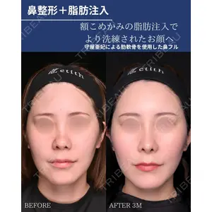 Zetith Beauty Clinic 銀座院 守屋 亜妃医師の症例