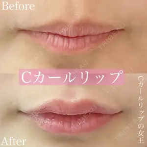 ルラ美容クリニック 渋谷本院 昼間 路子医師の症例