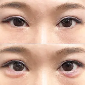 しのぶ皮膚科 蘇原しのぶ医師の症例