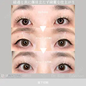PRO CLINIC プロクリニック 銀座院 洪 嵩典医師の症例