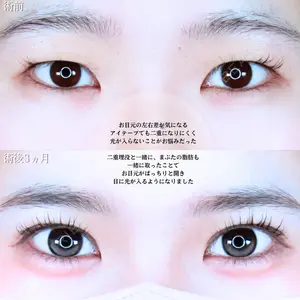 アリエル美容クリニック 水戸院 天白 典秀医師の症例