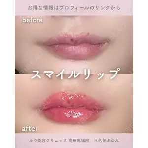 ルラ美容クリニック 高田馬場院 日名地 あゆみ医師の症例