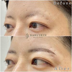 NARU Beauty Clinic 【ナルクリ】の症例