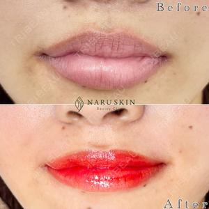 NARU Beauty Clinic 【ナルクリ】の症例