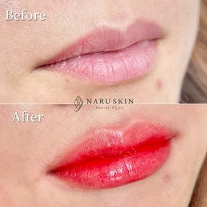 NARU Beauty Clinic 【ナルクリ】の症例