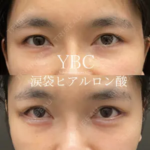 YBC横浜美容外科 池袋院 磯村 亮輔医師の症例