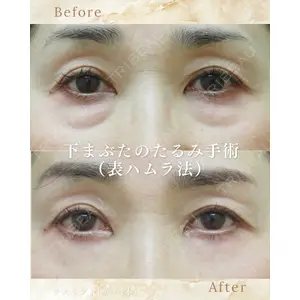 いわきタウン形成外科クリニック 工藤 勝秀医師の症例