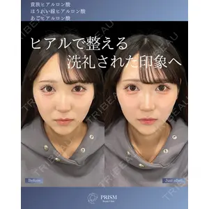 PRISM Beauty Clinic 町田院 森本 理一郎医師の症例