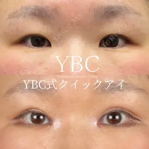 YBC横浜美容外科 池袋院 磯村 亮輔医師の症例