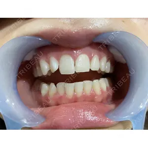 LEAGRANT CLINIC 中目黒 沼﨑 まい医師の症例