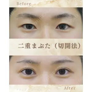 郡山タウン形成外科クリニック 石原 信浩医師の症例