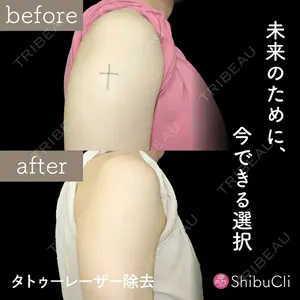 渋谷美容外科クリニック 渋谷院の症例