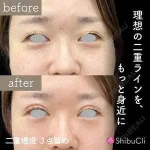 渋谷美容外科クリニック 渋谷院の症例