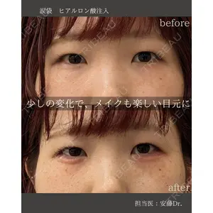 銀座美容外科クリニック 銀座院 安藤 有佳利医師の症例