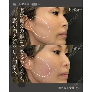 銀座美容外科クリニック 銀座院 安藤 有佳利医師の症例
