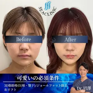 SEA CLINIC（シークリニック） 沼澤 茂医師の症例
