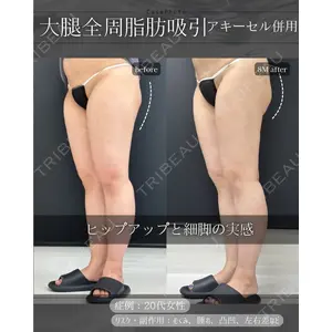 eクリニック 岡山院 勘定 正哉医師の症例