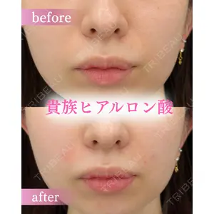 ルラ美容クリニック 町田院 松岡 舟作医師の症例