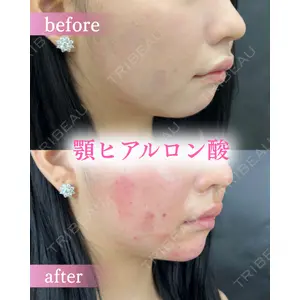 ルラ美容クリニック 町田院 松岡 舟作医師の症例