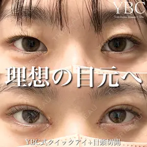 YBC横浜美容外科 池袋院 磯村 亮輔医師の症例
