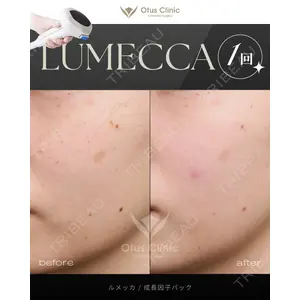 Otus Clinic 【オータスクリニック】 中 徳太郎医師の症例