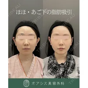 オアシス美容外科 遠藤 剛史医師の症例