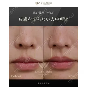 Otus Clinic 【オータスクリニック】 中 徳太郎医師の症例