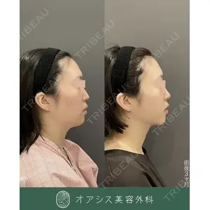 オアシス美容外科 遠藤 剛史医師の症例
