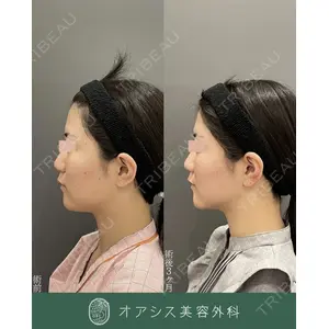 オアシス美容外科 遠藤 剛史医師の症例