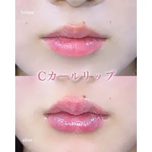 ルラ美容クリニック 町田院 松岡 舟作医師の症例
