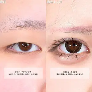 アリエル美容クリニック 横浜院 渡邉 光医師の症例