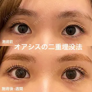 オアシス美容外科 遠藤 剛史医師の症例