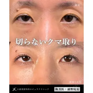 小倉美容外科ネビュラクリニック 浦野 正樹医師の症例
