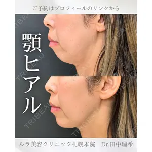 ルラ美容クリニック 札幌本院 田中 瑞希医師の症例