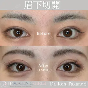 PRO CLINIC プロクリニック 銀座院 洪 嵩典医師の症例