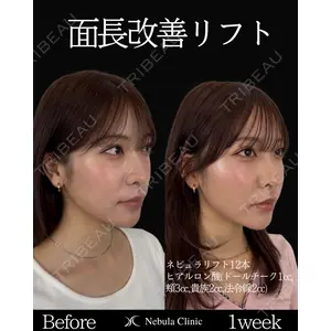 ネビュラクリニック 東京錦糸町院 岩切 琢磨医師の症例