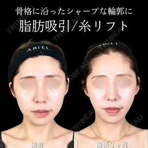 アリエル美容クリニック 大宮院 鈴木　桂介医師の症例