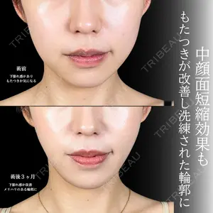 アリエル美容クリニック 大宮院 鈴木　桂介医師の症例