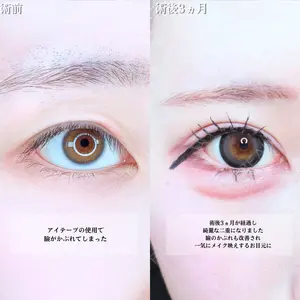 アリエル美容クリニック 水戸院 天白 典秀医師の症例