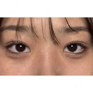 Moon Beauty Clinicの症例
