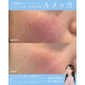 NYAN CLINIC 青木 胤磨医師の症例