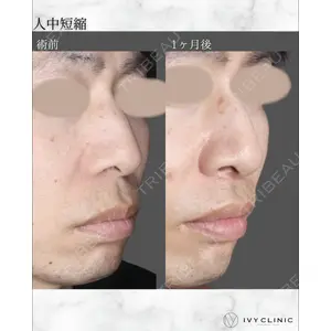 吉祥寺アイビークリニック 佐藤 （非常勤）医師の症例