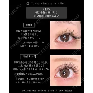 東京シンデレラ美容外科 新宿院 吉原 伯医師の症例