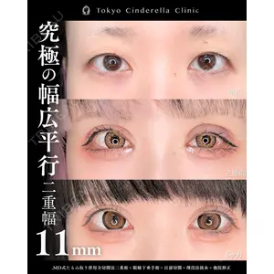 東京シンデレラ美容外科 新宿院 吉原 伯医師の症例
