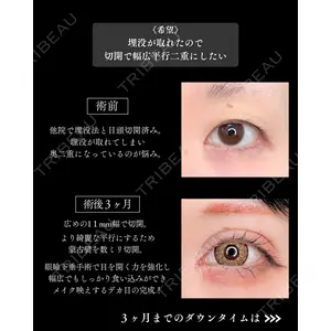 東京シンデレラ美容外科 新宿院 吉原 伯医師の症例
