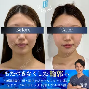SEA CLINIC（シークリニック） 沼澤 茂医師の症例