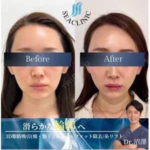 SEA CLINIC（シークリニック） 沼澤 茂医師の症例