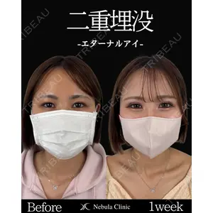 ネビュラクリニック 東京錦糸町院 岩切 琢磨医師の症例