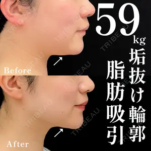 湘南美容クリニック 渋谷院 小草 智之医師の症例